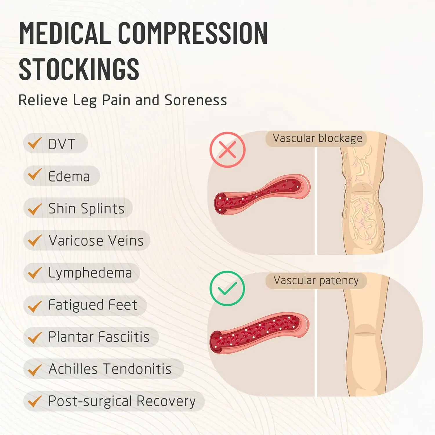 Thigh High 20-30 mmHg Compression Stocking, Open Toe Compression Socks for women & men circulation with Silicone Dot Band-Ideal for Athletic, Medical, Travel Use